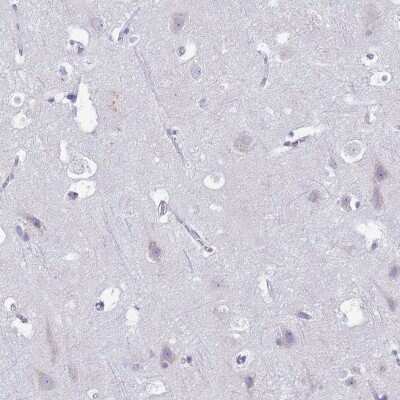 Immunohistochemistry-Paraffin: CD35 Antibody [NBP2-13871] - Staining of human cerebral cortex shows low expression as expected.