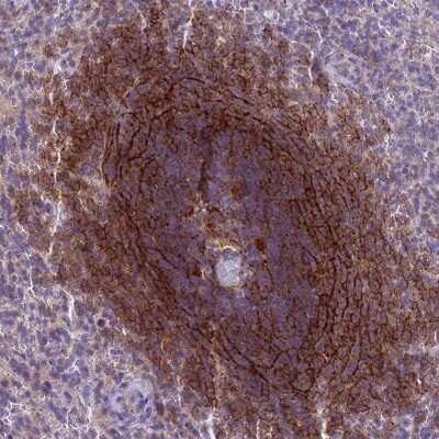 <b>Orthogonal Strategies Validation. </b>Immunohistochemistry-Paraffin: CD35 Antibody [NBP2-13871] - Staining of human spleen shows high expression.