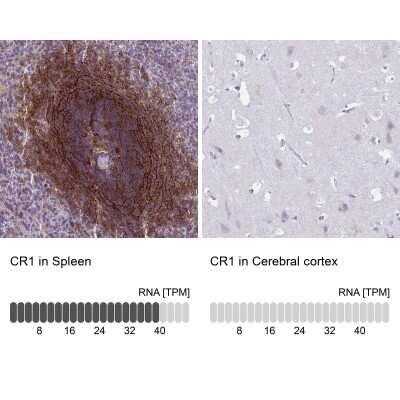 Immunohistochemistry-Paraffin: CD35 Antibody [NBP2-13871] - Staining in human spleen and cerebral cortex tissues using anti-CR1 antibody. Corresponding CR1 RNA-seq data are presented for the same tissues.