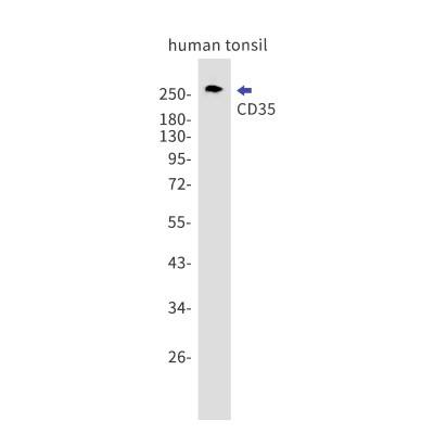 Western Blot: CD35 Antibody (S06-6D1) [NBP3-19598] - Western blot detection of CD35 in human tonsil lysates using NBP3-19598. Predicted band size: 224kDa. Observed band size: 280kDa.