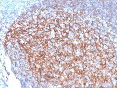 Immunohistochemistry-Paraffin: CD35 Antibody (SPM554) - Azide and BSA Free [NBP2-34796] - Formalin-fixed, paraffin-embedded human Tonsil stained with CD35 Antibody (SPM554).