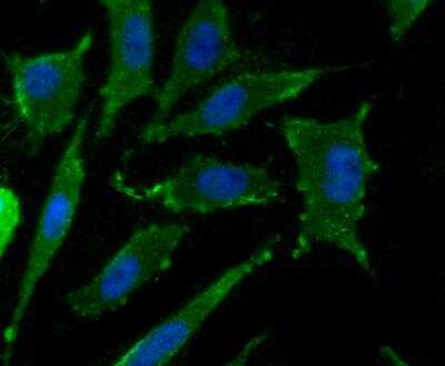 Immunocytochemistry/Immunofluorescence: CD36 Antibody [NBP3-09080] - ICC staining CD36 in SH-SY5Y cells (green). The nuclear counter stain is DAPI (blue). Cells were fixed in paraformaldehyde, permeabilised with 0.25% Triton X100/PBS.