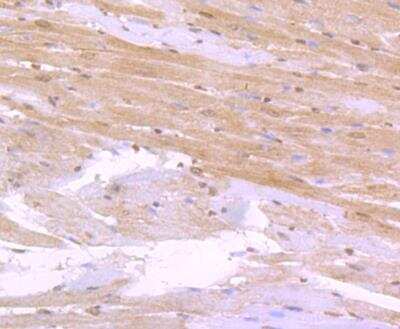 Immunohistochemistry-Paraffin: CD36 Antibody [NBP3-09080] - Immunohistochemical analysis of paraffin-embedded rat heart tissue using anti-CD36 antibody. Counter stained with hematoxylin.