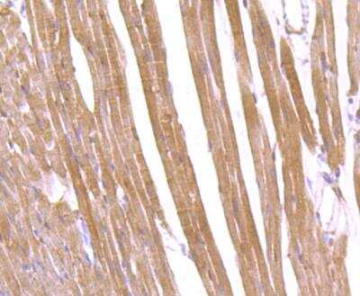 Immunohistochemistry-Paraffin: CD36 Antibody [NBP3-09080] - Immunohistochemical analysis of paraffin-embedded mouse heart tissue using anti-CD36 antibody. Counter stained with hematoxylin.