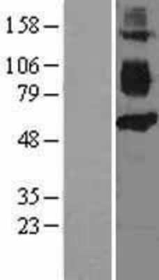 Western Blot: CD36 Overexpression Lysate [NBP2-08983] - Left-Empty vector transfected control cell lysate (HEK293 cell lysate); Right -Over-expression Lysate for CD36.