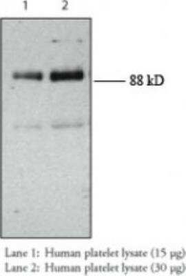 Western Blot: CD36/SR-B3 Antibody [NBP2-27414] -  Analysis of CD36 in human platelets using this antibody at 1:200.
