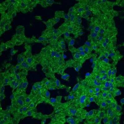 Immunocytochemistry/Immunofluorescence: CD38 Antibody (1G7F4) [NBP2-25250] - HuH-7 cells (human liver cancer cell line) stained with Alexa Fluor 647 conjugated CD38 antibody. Image using the Alexa Fluor 647 format of this antibody. ICC/IF image submitted by a verified customer review.