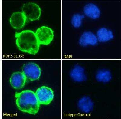 Immunocytochemistry/Immunofluorescence: CD38 Antibody (AT13/5) [NBP2-81055] - Immunofluorescence staining of fixed Daudi cells with anti-CD38 antibody AT13/5 [NBP2-81055]. Immunofluorescence analysis of paraformaldehyde fixed Daudi cells on Shi-fix coverslips, permeabilized with 0.15% Triton and stained with the chimeric rabbit IgG version of AT13/5 [NBP2-81055] at 10 ug/mL for 1h followed by Alexa Fluor 488 secondary antibody (1 ug/mL), showing membrane staining. The nuclear stain is DAPI (blue). Panels show from left-right, top-bottom NBP2-81055, DAPI, merged channels and an isotype control. The isotype control was stained with an anti-Fluorescein antibody followed by Alexa Fluor 488 secondary antibody.