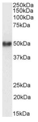Western Blot: CD38 Antibody (AT13/5) [NBP2-81055] - Western Blot using anti-CD38 antibody (AT13/5) [NBP2-81055]. Human spleen lysate samples (35 ug protein in RIPA buffer) were resolved on a 10% SDS PAGE gel and blots probed with the chimeric rabbit version of AT13/5 [NBP2-81055] at 1 ug/mL before detection using an anti-rabbit secondary antibody. A primary incubation of 1h was used and protein was detected by chemiluminescence. The expected running size for CD38 is 34.3 kDa, but this protein is glycosylated at several residues. NBP2-81055 successfully detected CD38 in human spleen lysate.