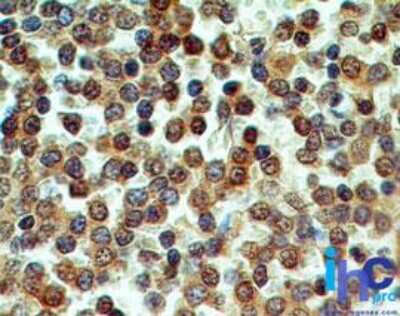 Immunohistochemistry-Paraffin: CD39/ENTPD1 Antibody (17B5F11) - Azide Free [NBP2-25226] - Formalin-fixed, paraffin-embedded normal human spleen tissue stained with CD39 antibody (5 ug/ml), peroxidase-conjugate and DAB chromogen.