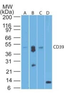 Western Blot: CD39/ENTPD1 Antibody (17B5F11) - Azide Free [NBP2-25226] - analysis of human (A), mouse (B), and rat brain (C) and a recombinant protein fragment (D) using CD39 antibody at 1 ug/ml.