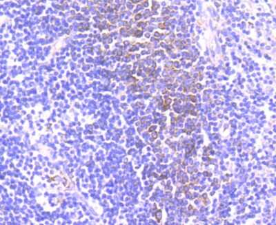 Immunohistochemistry-Paraffin: CD39/ENTPD1 Antibody (JA90-36) [NBP2-67230] - Analysis of paraffin-embedded human spleen tissue using anti-CD39 antibody. Counter stained with hematoxylin.