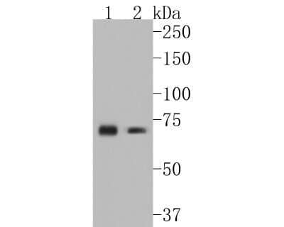 Western Blot: CD39/ENTPD1 Antibody (JA90-36) [NBP2-67230] - Western blot analysis of CD39/ENTPD1 on different lysates. Proteins were transferred to a PVDF membrane and blocked with 5% BSA in PBS for 1 hour at room temperature. The primary antibody (1/500) was used in 5% BSA at room temperature for 2 hours. Goat Anti-Rabbit IgG - HRP Secondary Antibody (HA1001) at 1:5,000 dilution was used for 1 hour at room temperature. Positive control: Lane 1: mouse heart tissue lysate Lane 2: mouse spleen tissue lysate