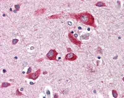 Immunohistochemistry-Paraffin: CD39L1/ENTPD2 Antibody [NBP1-44241] - Analysis of anti-ENTPD2 antibody with human brain, cortex.