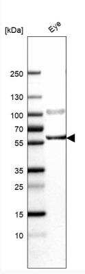 Western Blot: CD39L1/ENTPD2 Antibody [NBP1-85752] - Analysis in human eye tissue.