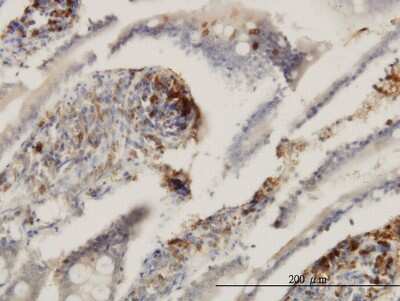 Immunohistochemistry-Paraffin: CD39L2/ENTPD6 Antibody (2D10) [H00000955-M03] - Analysis of monoclonal antibody to ENTPD6 on formalin-fixed paraffin-embedded human small Intestine. Antibody concentration 3 ug/ml