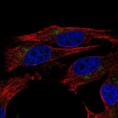 Immunocytochemistry/Immunofluorescence: CD39L2/ENTPD6 Antibody [NBP2-58760] - Staining of human cell line SK-MEL-30 shows localization to the Golgi apparatus.