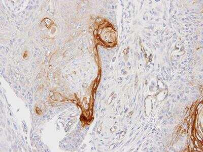 Immunohistochemistry-Paraffin: CD39L2/ENTPD6 Antibody [NBP1-32294] - Ca922 xenograft, using ENTPD6 antibody at 1:100 dilution. Antigen Retrieval: Trilogy™ (EDTA based, pH 8.0) buffer, 15min.
