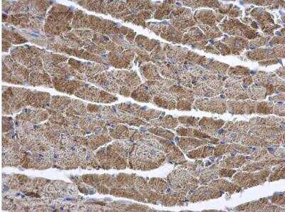 Immunohistochemistry-Paraffin: CD39L2/ENTPD6 Antibody [NBP1-32294] - Mouse heart. ENTPD6 antibody [N1C1] diluted at 1:500. Antigen Retrieval: Trilogy™ (EDTA based, pH 8.0) buffer, 15min.