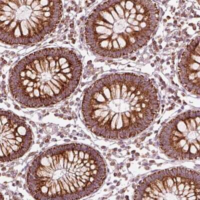 Immunohistochemistry-Paraffin: CD39L2/ENTPD6 Antibody [NBP2-57315] - Immunohistochemical staining of human colon shows strong cytoplasmic positivity  in glandular cells.