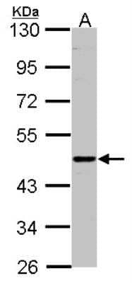 Western Blot: CD39L2/ENTPD6 Antibody [NBP1-32294] - Sample(30 ug of whole cell lysate)A:H1299 7. 5% SDS PAGE, antibody diluted at 1:500.