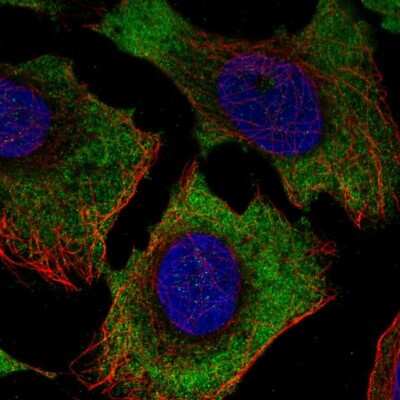 Immunocytochemistry/Immunofluorescence: CD39L3/ENTPD3 Antibody [NBP2-57781] - Staining of human cell line U-2 OS shows localization to cytosol.
