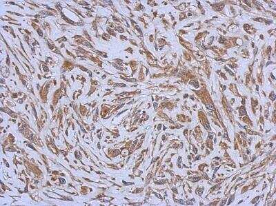 Immunohistochemistry-Paraffin: CD39L3/ENTPD3 Antibody [NBP1-32471] - Paraffin-embedded U37C xenograft, using antibody at 1:500 dilution.