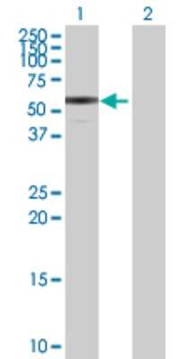Western Blot: CD39L3/ENTPD3 Antibody [H00000956-D01P] - Analysis of ENTPD3 expression in transfected 293T cell line by ENTPD3 polyclonal antibody.Lane 1: ENTPD3 transfected lysate(50.70 KDa).Lane 2: Non-transfected lysate.