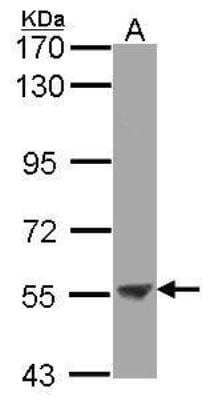 Western Blot CD39L3/ENTPD3 Antibody - BSA Free