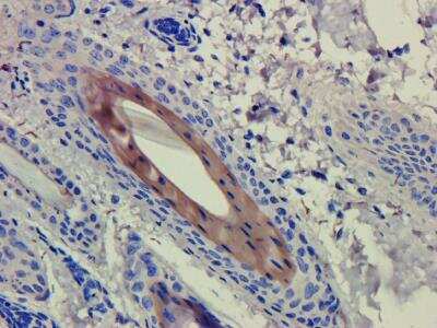 Immunohistochemistry: CD4 Antibody (CE9.1 (Clenoliximab)) [NBP2-75910] - Anti-CD4 staining of formaldehyde fixed paraffin embedded guinea pig skin tissue, at 40x magnification. The human IgG4-chimeric version of CE9.1 (Clenoliximab) (NBP2-75910) was used to stain samples at a concentration of 3 ug/ml.