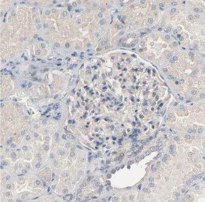 Immunohistochemistry-Paraffin: CD4 Antibody [NBP1-86143] - Staining of human kidney shows negative membranous positivity in a subset of cells in glomeruli.