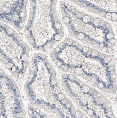 Immunohistochemistry-Paraffin: CD4 Antibody [NBP1-86143] - Staining of human small intestine shows negative membranous positivity in a subset of glandular cells.
