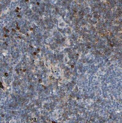 Immunohistochemistry-Paraffin: CD4 Antibody [NBP1-86143] - Staining of human lymph node shows moderate membranous positivity in non-germinal center cells.
