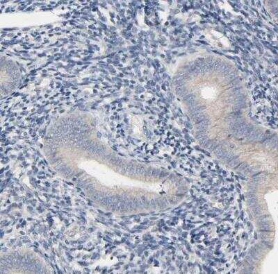 Immunohistochemistry-Paraffin: CD4 Antibody [NBP1-86143] - Staining of human endometrium shows negative membranous positivity in a subset of glandular cells.