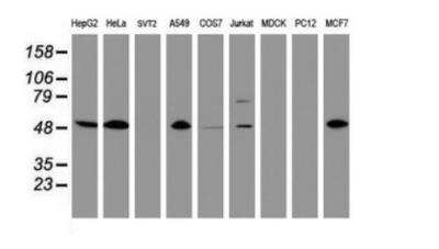 CD4 Antibody (OTI5D9) - Azide and BSA Free [NBP2-70357] - Analysis of extracts (35ug) from 9 different cell lines by using anti-CD4 monoclonal antibody (HepG2: human; HeLa: human; SVT2: mouse; A549: human; COS7: monkey; Jurkat: human; MDCK: canine; PC12: rat; MCF7: human).
