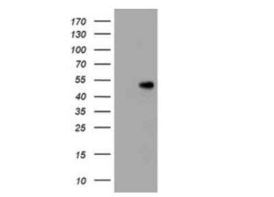Western Blot: CD4 Antibody (OTI5D9) - Azide and BSA Free [NBP2-70357] - HEK293T cells were transfected with the pCMV6-ENTRY control (Left lane) or pCMV6-ENTRY CD4 ( Right lane) cDNA for 48 hrs and lysed. Equivalent amounts of cell lysates (5 ug per lane) were separated by SDS-PAGE and immunoblotted with anti-CD4. Positive lysates .