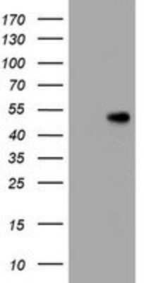 Western Blot: CD4 Antibody (OTI5D9) [NBP2-46149] - Analysis of HEK293T cells were transfected with the pCMV6-ENTRY control (Left lane) or pCMV6-ENTRY CD4.