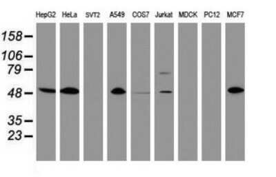 Western Blot: CD4 Antibody (OTI5D9) [NBP2-46149] - Analysis of extracts (35ug) from 9 different cell lines (HepG2: human; HeLa: human; SVT2: mouse; A549: human; COS7: monkey; Jurkat: human; MDCK: canine; PC12: rat; MCF7: human).