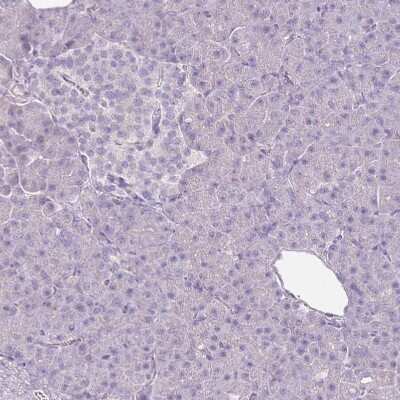 Immunohistochemistry: CD40 Ligand/TNFSF5 Antibody [NBP1-91770] - Staining of human pancreas shows no positivity in exocrine glandular cells as expected.