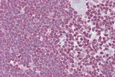 Immunohistochemistry-Paraffin: CD40 Ligand/TNFSF5 Antibody [NBP1-59186] - Human thymus tissue at an antibody concentration of 5ug/ml.