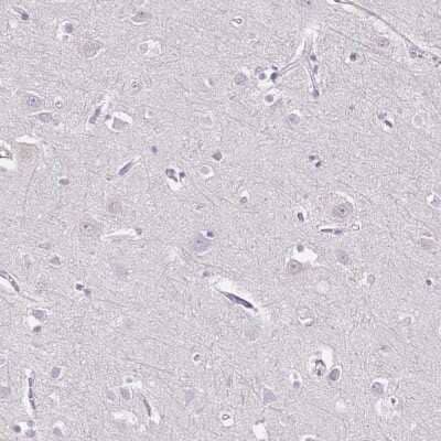 Immunohistochemistry-Paraffin: CD40 Ligand/TNFSF5 Antibody [NBP1-91770] - Staining of human cerebral cortex shows no positivity in neurons as expected.