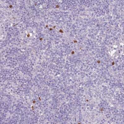 Immunohistochemistry-Paraffin: CD40 Ligand/TNFSF5 Antibody [NBP1-91770] - Staining of human lymph node shows strong cytoplasmic positivity in leukocytes.