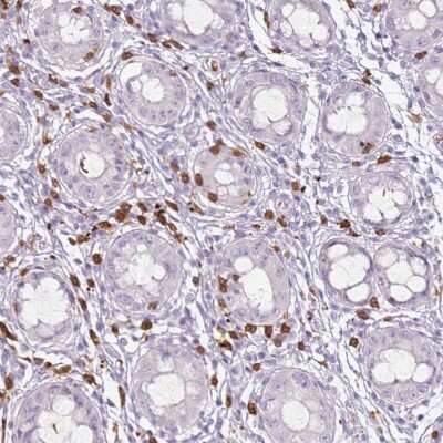 Immunohistochemistry-Paraffin: CD40 Ligand/TNFSF5 Antibody [NBP1-91770] - Staining of human rectum shows strong cytoplasmic positivity in leukocytes.