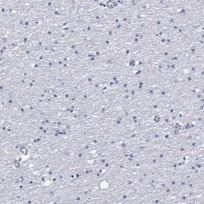 Immunohistochemistry-Paraffin: CD40 Ligand/TNFSF5 Antibody [NBP3-16982] - Staining of human cerebral cortex shows low expression as expected.