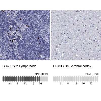 Immunohistochemistry-Paraffin: CD40 Ligand/TNFSF5 Antibody [NBP3-16982] - Analysis in human lymph node and cerebral cortex tissues using Anti-CD40LG antibody. Corresponding CD40LG RNA-seq data are presented for the same tissues.