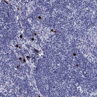 Immunohistochemistry-Paraffin: CD40 Ligand/TNFSF5 Antibody [NBP3-16982] - Staining of human lymph node shows high expression.