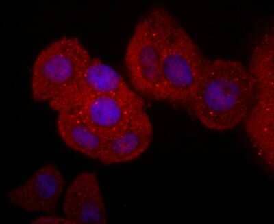 Immunocytochemistry/Immunofluorescence: CD40 Ligand/TNFSF5 Antibody (JM11-34) [NBP2-66756] - Staining CD40L in MCF-7 cells (red). The nuclear counter stain is DAPI (blue). Cells were fixed in paraformaldehyde, permeabilised with 0.25% Triton X100/PBS.