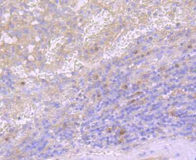 Immunohistochemistry-Paraffin: CD40 Ligand/TNFSF5 Antibody (JM11-34) [NBP2-66756] - Analysis of paraffin-embedded human spleen tissue using anti- CD40L antibody. Counter stained with hematoxylin.