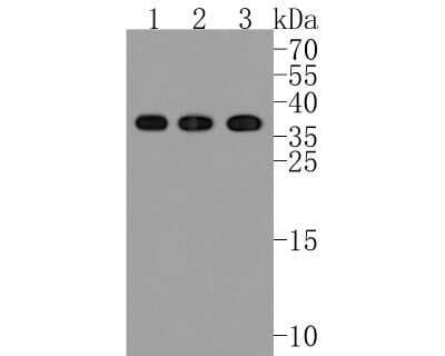 Western Blot: CD40 Ligand/TNFSF5 Antibody (JM11-34) [NBP2-66756] - Western blot analysis of CD40 Ligand/TNFSF5 on different lysates. Proteins were transferred to a PVDF membrane and blocked with 5% BSA in PBS for 1 hour at room temperature. The primary antibody (1/500) was used in 5% BSA at room temperature for 2 hours. Goat Anti-Rabbit IgG - HRP Secondary Antibody (HA1001) at 1:5,000 dilution was used for 1 hour at room temperature. Positive control: Lane 1: mouse liver tissue lysate Lane 2: rat liver tissue lysate Lane 2: mouse bone marrow tissue lysate