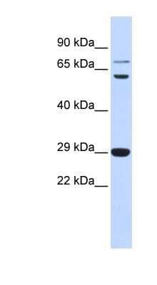 Western Blot: CD40 Ligand/TNFSF5 Antibody [NBP1-59186] - Titration: 0.2-1 ug/ml, Positive Control: Human Muscle.